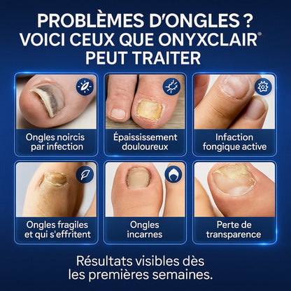 OnyxClair™ - Patchs Ongles Fongiques