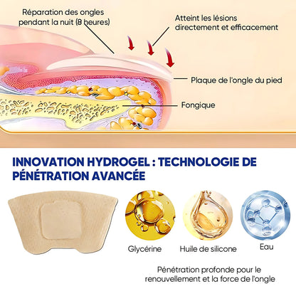 OnyxClair™ - Patchs Ongles Fongiques