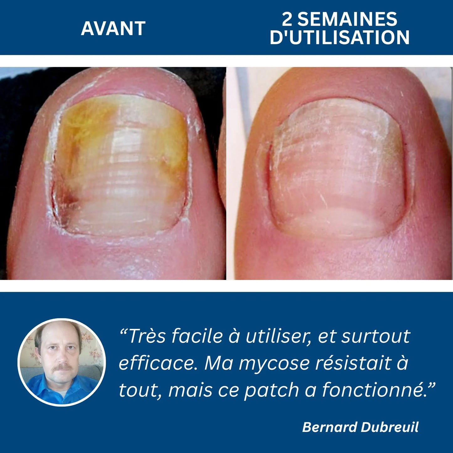 LumiNail Pro
